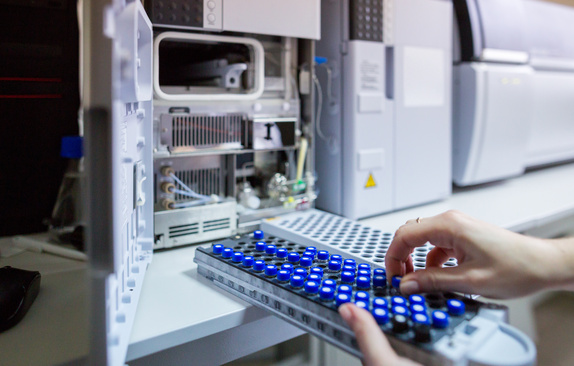 The laboratory scientist prepares samples to High-performance LC/MS